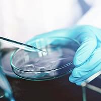 低負担で効果に優れる再生医療を追究